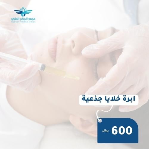 ابرة الخلايا الجذعية