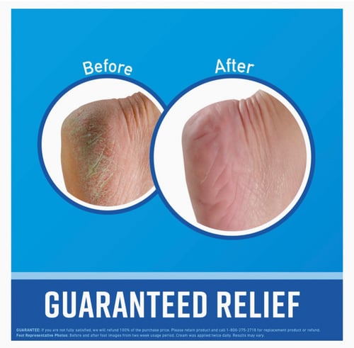 أكيفيز كريم إصلاح القدمين 76 جم