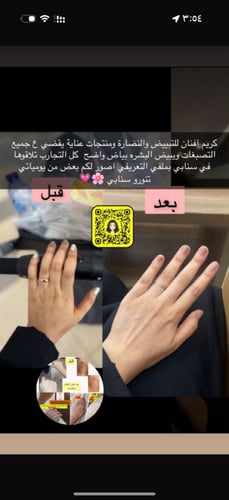 كريم التبييض والنضارة ١٥٠ مل