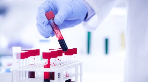 باقة التحليل الشامل الذهبي (14 تحليل)