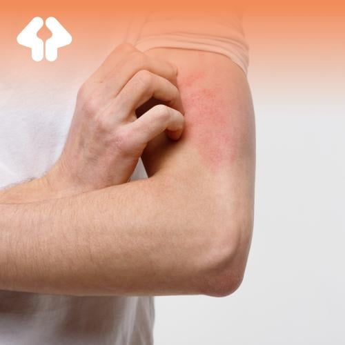 باقة الحساسية