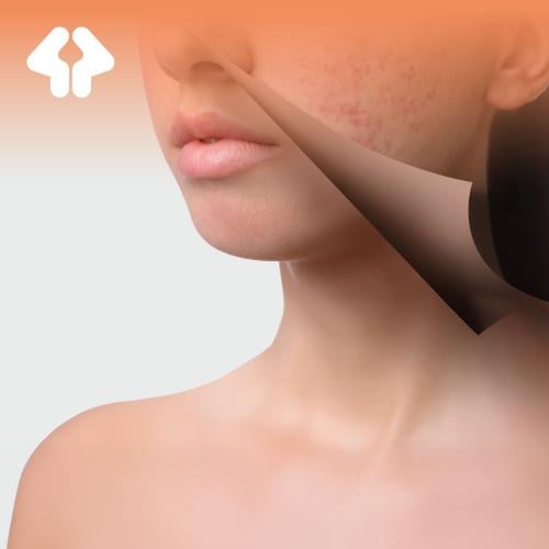 باقة تحليل الروكتان