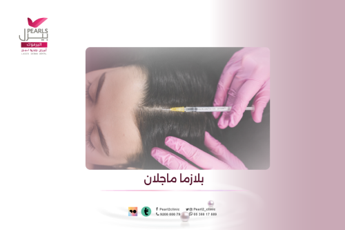 بلازما ماجلان