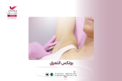 بوتكس التعرق
