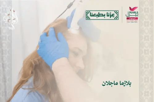 بلازما ماجلان
