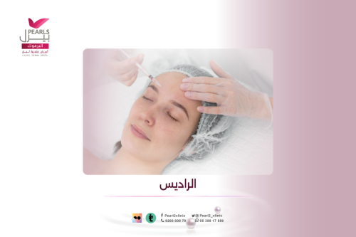 راديس