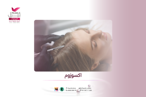 إكسوزوم