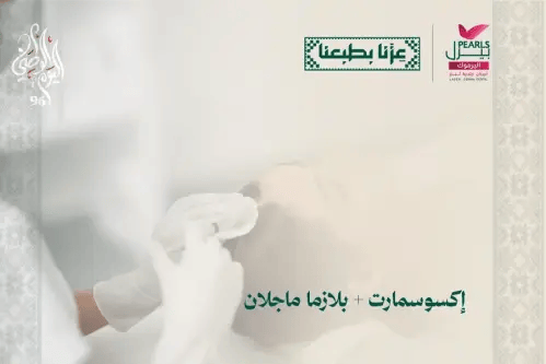 اكسوسمارت و بلازما ماجلان