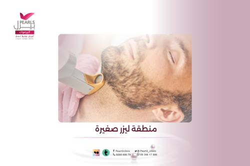 منطقة ليزر صغيره