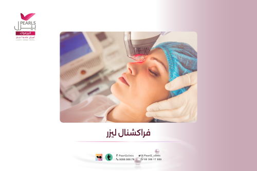 فراكشنال ليزر