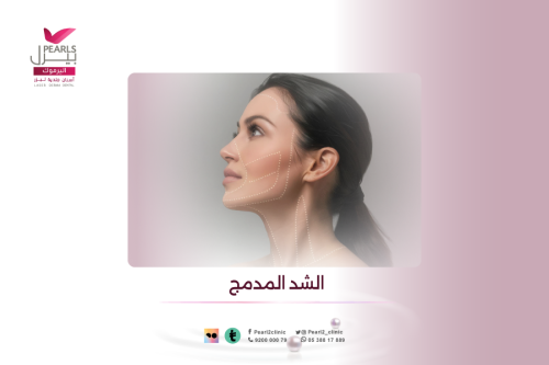 الشد المدمج
