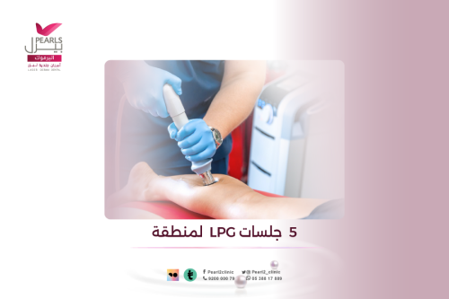 5 جلسات LBG لمنطقة
