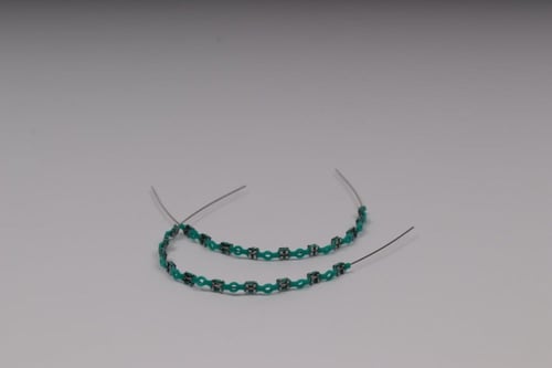 تقويم اسنان بغرا (فكين)