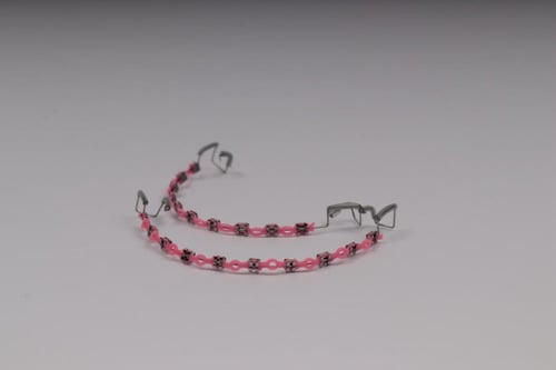 تقويم اسنان بدون غرا (فكين)