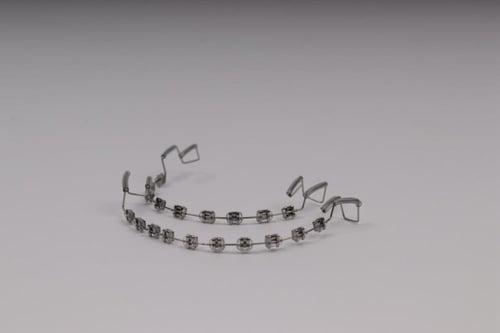 تقويم اسنان بدون غرا (فكين)