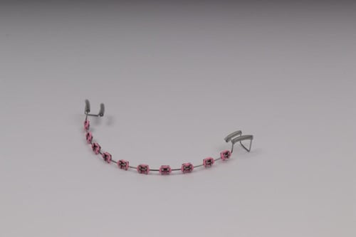 تقويم اسنان بدون غرا (فك واحد)