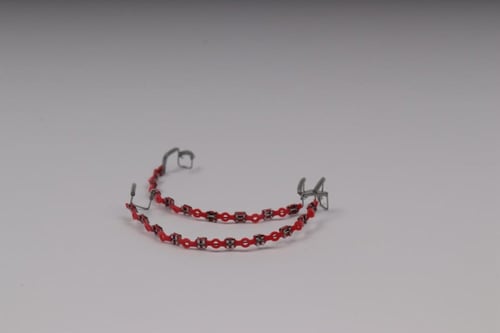 تقويم اسنان بدون غرا (فكين)