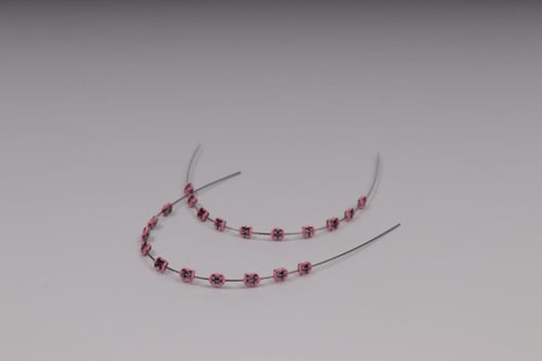 تقويم اسنان بغرا(فكين)