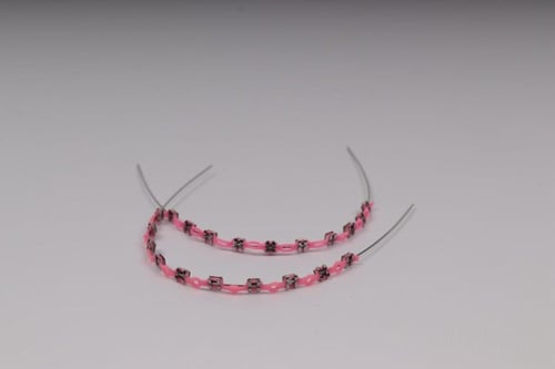 تقويم اسنان بغرا (فكين)