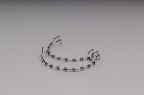 تقويم اسنان بدون غرا (فكين)