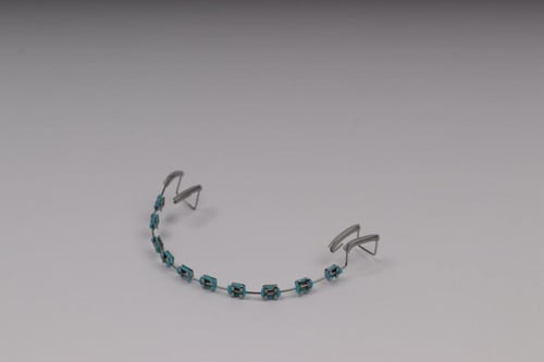 تقويم اسنان بدون غرا (فك واحد)