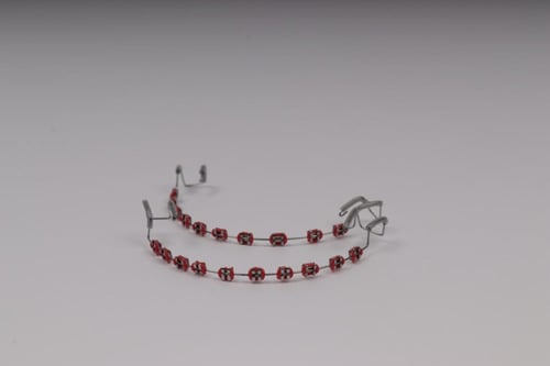 تقويم اسنان بدون غرا (فكين)