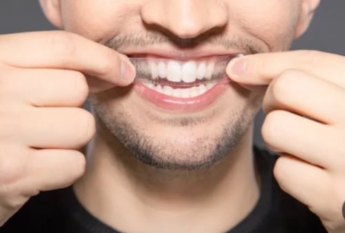 لصقات تبيض الأسنان المطورة 5D