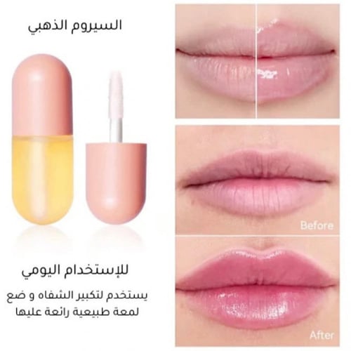 قلوس تكبير الشفايف