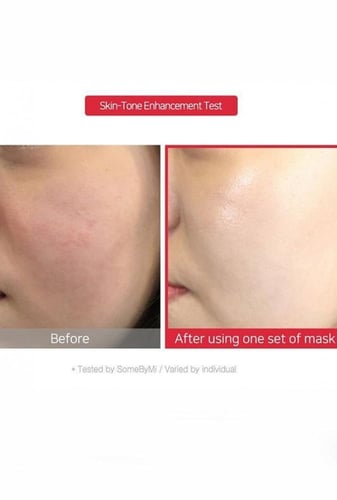 قناع الألماس الأحمر لتفتيح البشرة من سوم باي مي -...