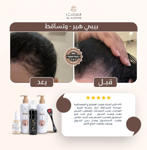 مجموعة كثافة الشعر والحد من التساقط