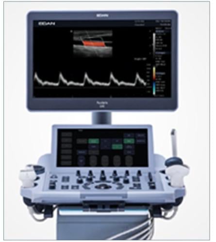 Diagnostic Ultrasound - Acclarix LX3 - 1Probe 2Scr...