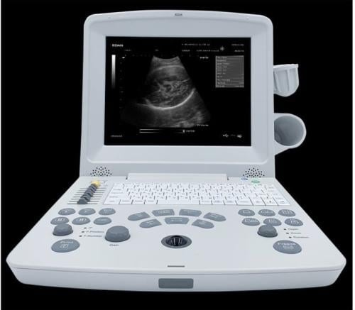 جهاز الموجات فوق الصوتية Diagnostic Ultrasound - D...
