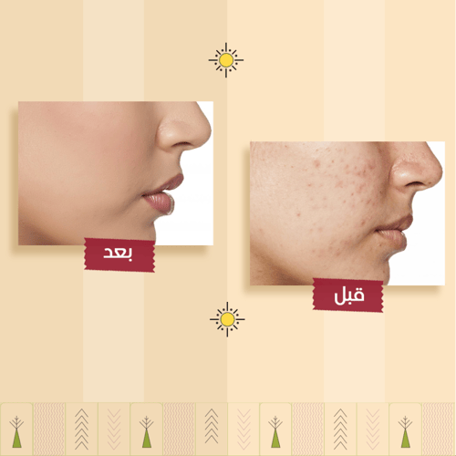 روتين تجديد البشرة