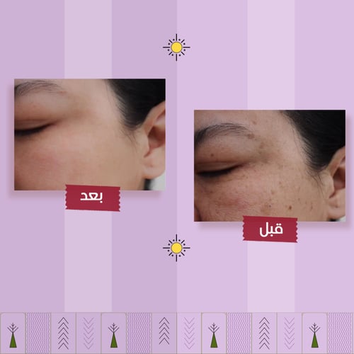 واقي شمس حماية عالية SPF 50