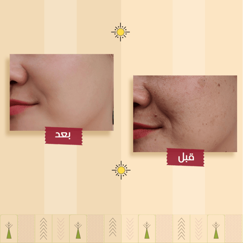 مجموعة العناية العميقة بالبشرة