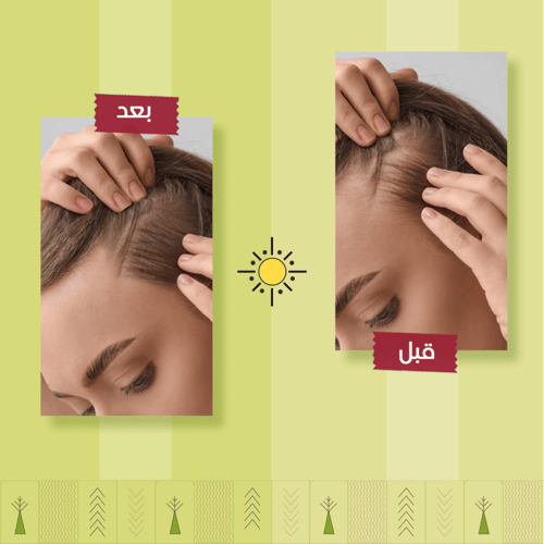 مجموعة علاج تساقط الشعر من أشري ناتشورال