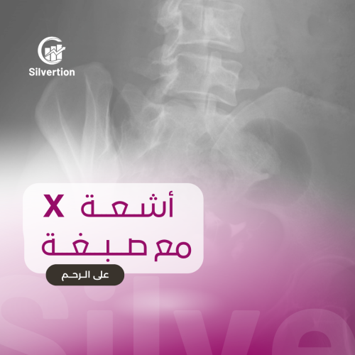 أشعة X مع صبغة على الرحم