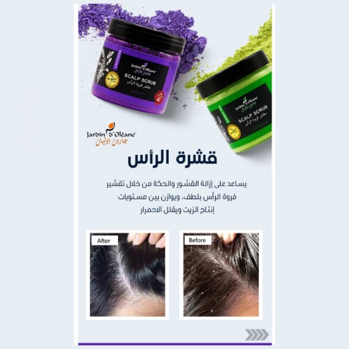 مقشر فروة الرأس بالحوامض