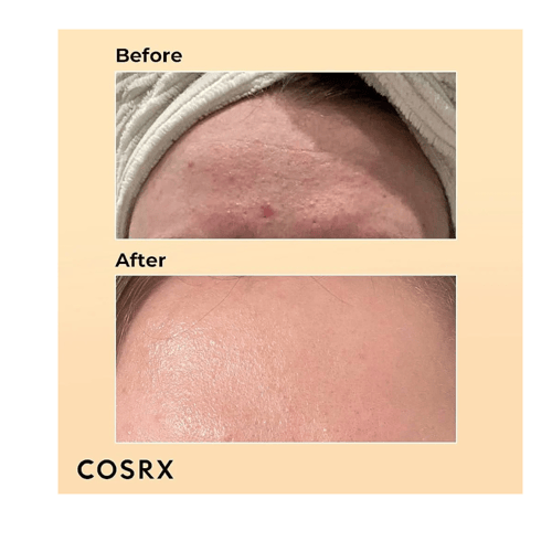 سيروم اسنس موسين الحلزون COSRX