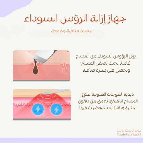 جهاز إزالة الرؤوس السوداء