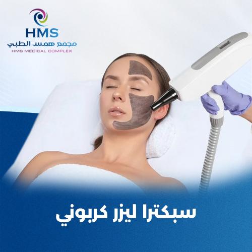 ليزر كربوني