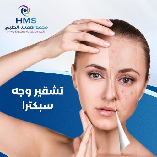 تشقير وجه + ليزر كربوني