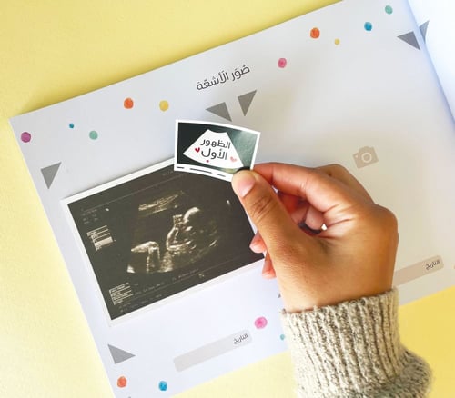 سنواتي الصغيرة مذكرات طفلتي (انثى)