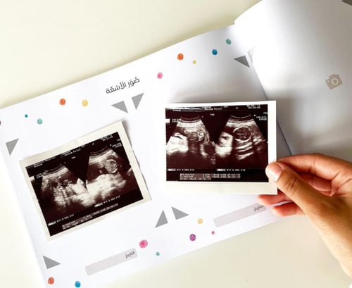 سنواتي الصغيرة مذكرات طفلي (ذكر/محايد)