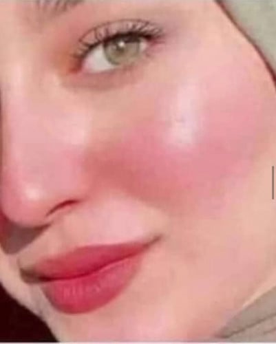 توريد الخدود بلاشر طبيعي