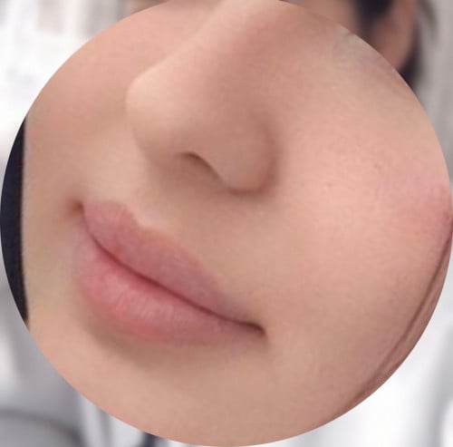 جلسه تنحيف ونحت الانف