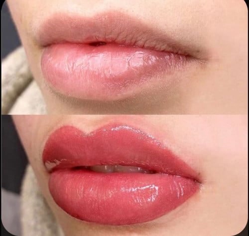 جلسة رتوش للشفاه