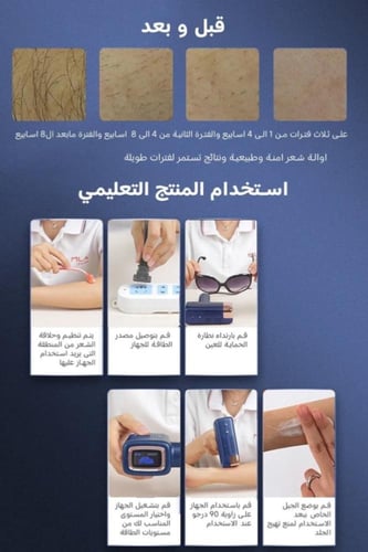 ليزر ملاي T14 ثلاث عدسات