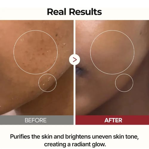 تونر الارز الابيض المعزز للاشراقة والترطيب من دكتو...