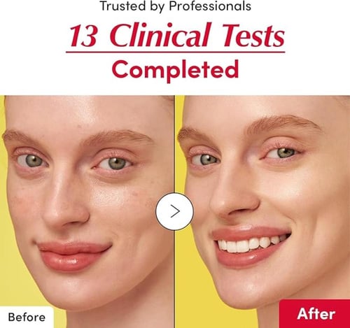 سيروم ايكوال بيري فيتامين لتوحيد لون البشرة 30 مل...